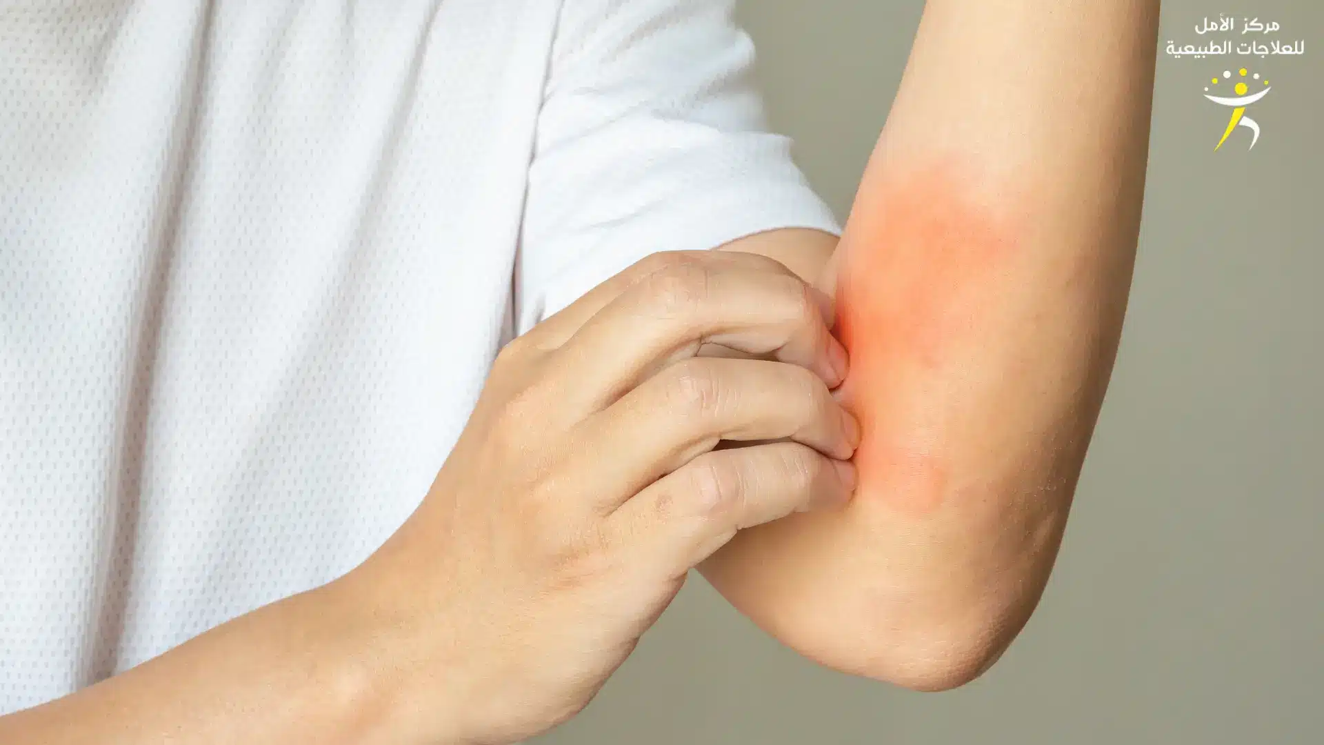 خطوات العلاج بتقنية NAET خطوات العلاج بتقنية NAET